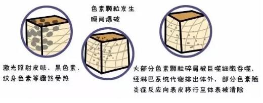 光子嫩膚,嫩膚方法,黑臉娃娃,光子嫩膚價格,家用美容儀