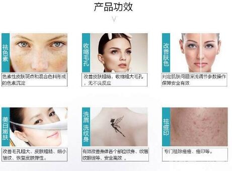 皮秒激光祛斑,775蜂巢皮秒激光祛斑儀,激光美容儀器,皮秒激光祛斑感覺
