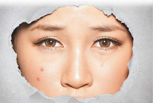 拒當(dāng)「痘花妹」！看痘痘生長的位置判斷也許是身體出了問題