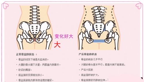 產(chǎn)后修復(fù)的項(xiàng)目有哪些？最好用是什么樣的產(chǎn)后修復(fù)儀器？