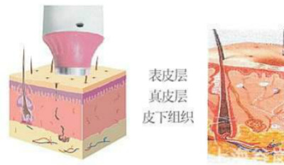 什么叫RF射頻技術(shù)？