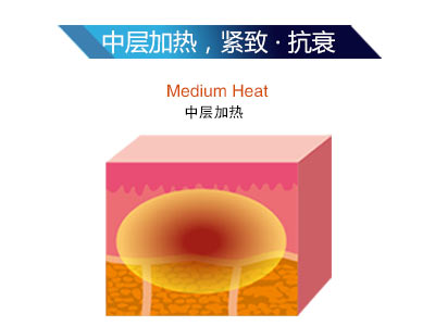 時光精雕儀是什么？為什么這么火