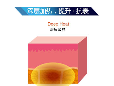 時光精雕儀是什么？為什么這么火