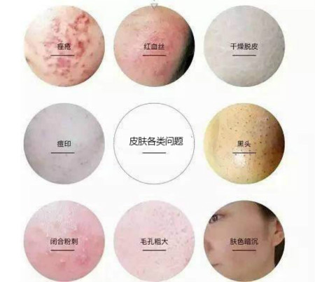 你知道補(bǔ)水對皮膚到底有多重要嗎？