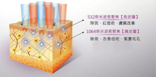 超皮秒比皮秒高大上？你怕是想多了