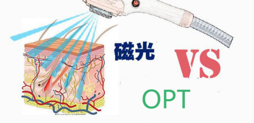什么是360磁光脫毛儀？磁光與OPT哪個效果更好