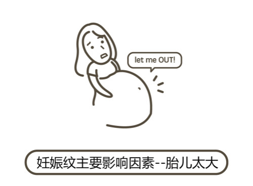 一文秒懂！妊娠紋肥胖紋保養(yǎng)、治療及預防全攻略