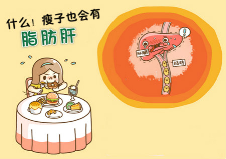 什么！瘦子也會有「脂肪肝」？