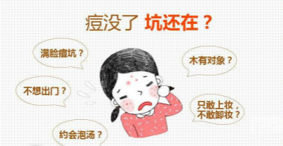 激光去痘印方法你適合嗎？