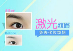 飄眉或霧眉適合那些人？激光洗眉機關(guān)鍵要點有哪些？
