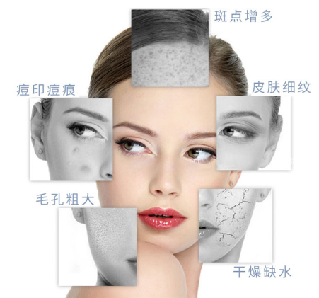 小氣泡美容儀怎么辨別品質(zhì)的優(yōu)劣呢？