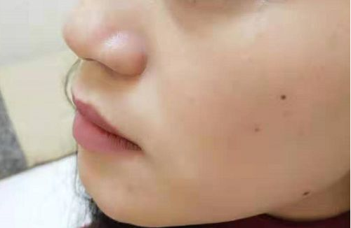 小氣泡美容儀器到底值不值的做呢！