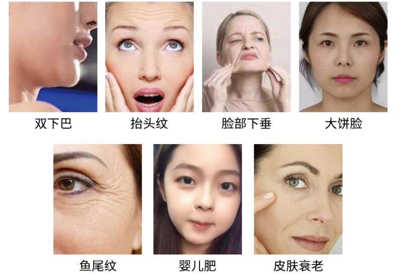 美容儀廠家教您怎么預(yù)防臉上長(zhǎng)斑，要注意什么?