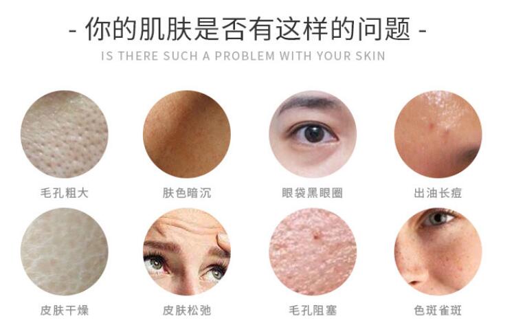 光子嫩膚美容儀器的美容效果和存在的風(fēng)險(xiǎn)！