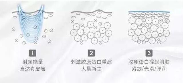 家用射頻美容儀怎么選？小心交了智商稅！