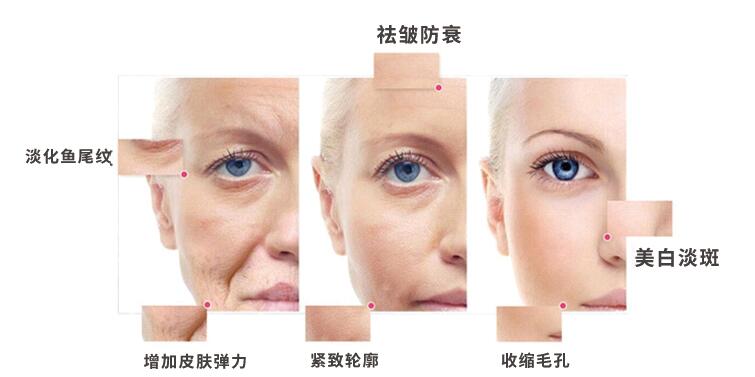 射頻美容儀的試用注意事項都有哪些？