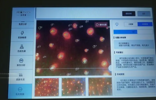 皮膚檢測(cè)儀對(duì)于美容院來說有哪些作用？